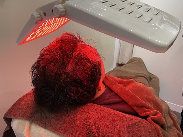 薄毛・毛量アップ